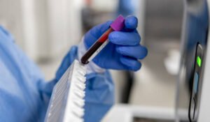 First “Gwanda-Negative” Human Blood Type Discovered